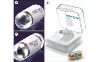 Capsule Endoscopy