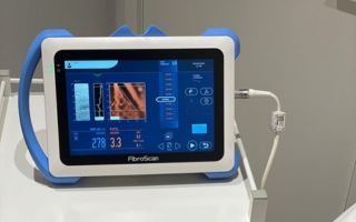 Fibroscan