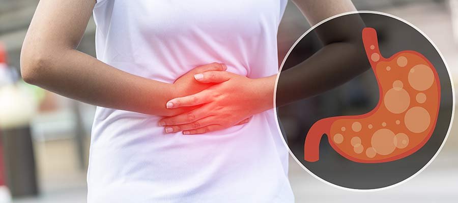 Bloating illustration