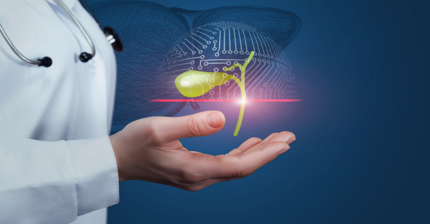 Gallbladder stone visual