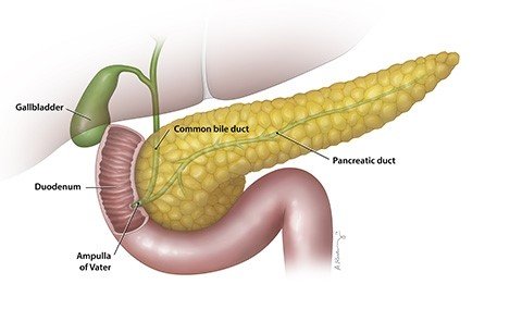 Pancreas disorders illustration
